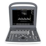 Portable ultrasound system  ECO2-جهاز سونار محمول