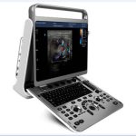 Portable ultrasound system  EBit 30-جهاز سونار محمول