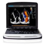 Portable ultrasound system  SonoBook 9-جهاز سونار محمول