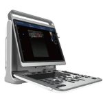 Portable ultrasound system  EBit 50-جهاز سونار محمول