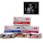 ورق لاجهزة الموجات فوق الصوتية / ورق طابعة