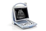 Portable Full Digital Ultrasound DP-20-جهاز سونار ديجيتال - Image 3