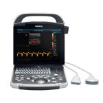 Portable Full Digital Ultrasound DP-30-جهاز سونار ديجيتال