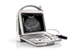 Portable Full Digital Ultrasound DP-30-جهاز سونار ديجيتال - Image 2